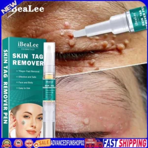 5ml Skin Tag Remover Pen